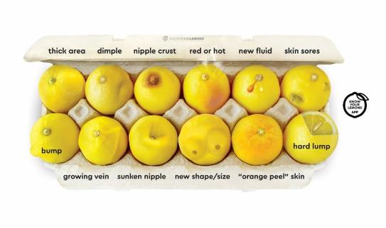 Citrons représentant les symptômes du cancer du sein - description détaillée disponible