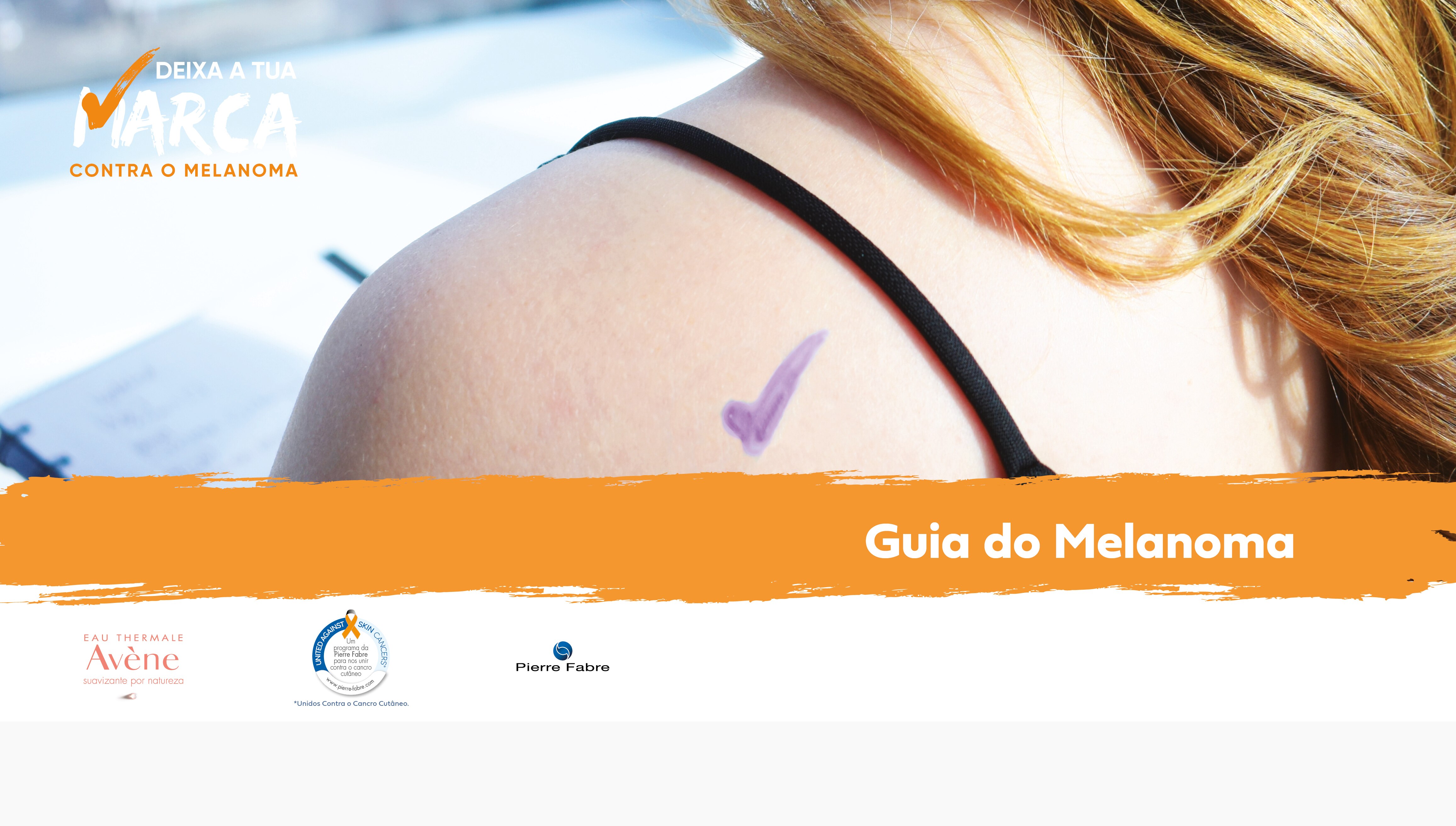 Guia do melanoma