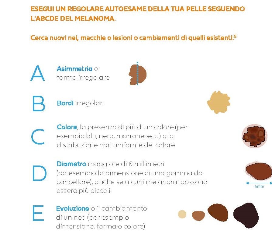 Melanoma Metodo ABCDE