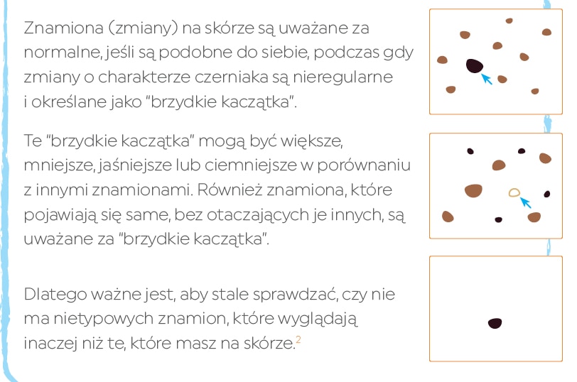Melanoma brzydkie kaczątko