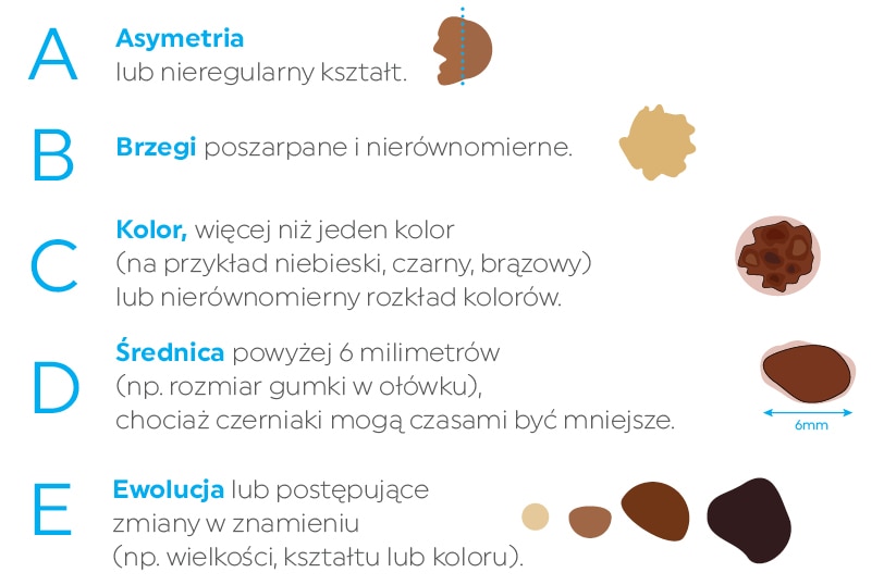 Zasady ABCDE czerniaka
