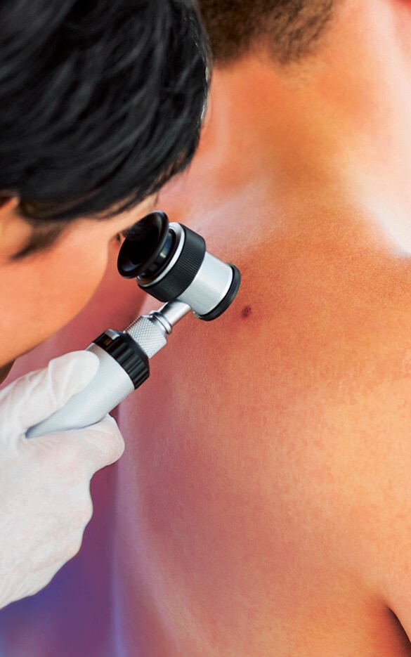 Un dermatologue examine la peau d'un patient avec un dermatoscope
