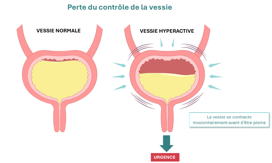le dessin du contrôle de la vessie