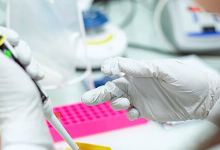 Gros plan des mains d'un scientifique utilisant une pipette pour transférer du liquide dans un récipient jaune&quot;.