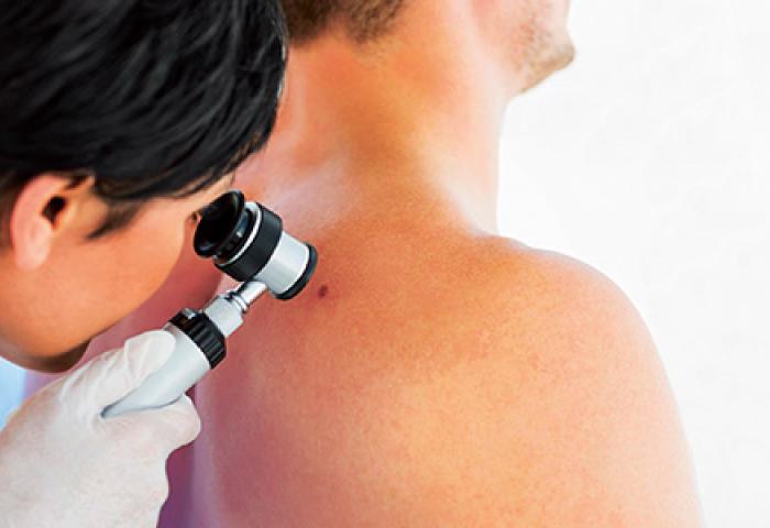 Un dermatologue examine la peau d'un patient avec un dermatoscope