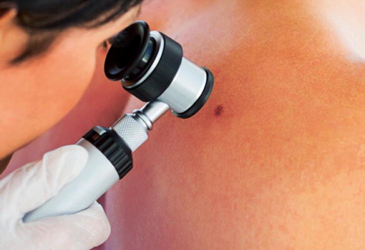 Un dermatologue examine la peau d'un patient avec un dermatoscope